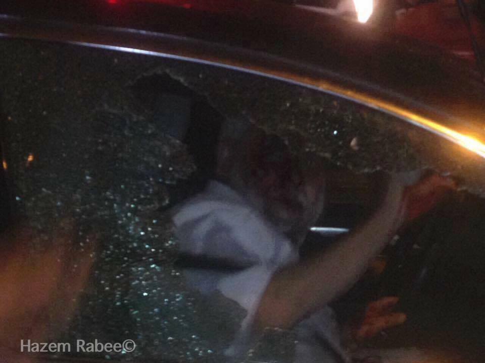 إصابة مستوطنين في حادثين منفصلين بالقدس ونابلس اصابة مستوطنين