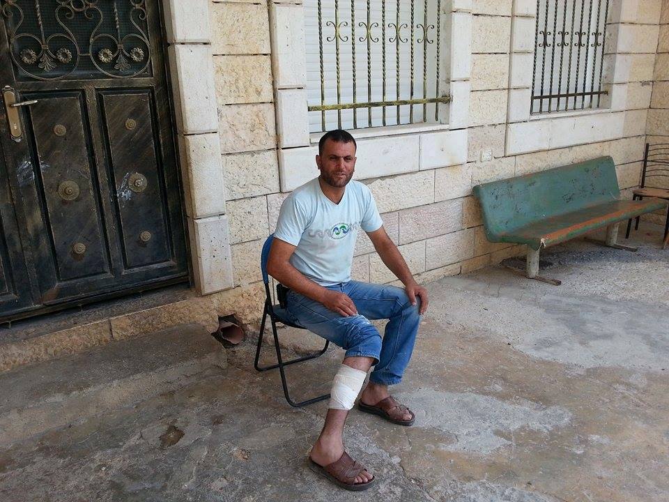 إصابة شاب جراء إطلاق المستوطنين النار عليه جنوب بيت لحم