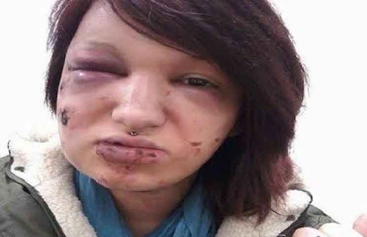 عضّها 21 مرّة حتّى لا ينظر إليها أيّ رجلٍ آخر