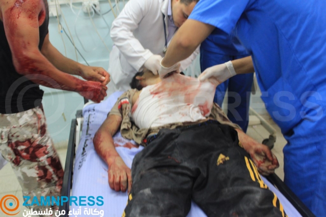 مالطا تتكفل بعلاج أطفال من مصابي العدوان الإسرائيلي على غزة مصاب