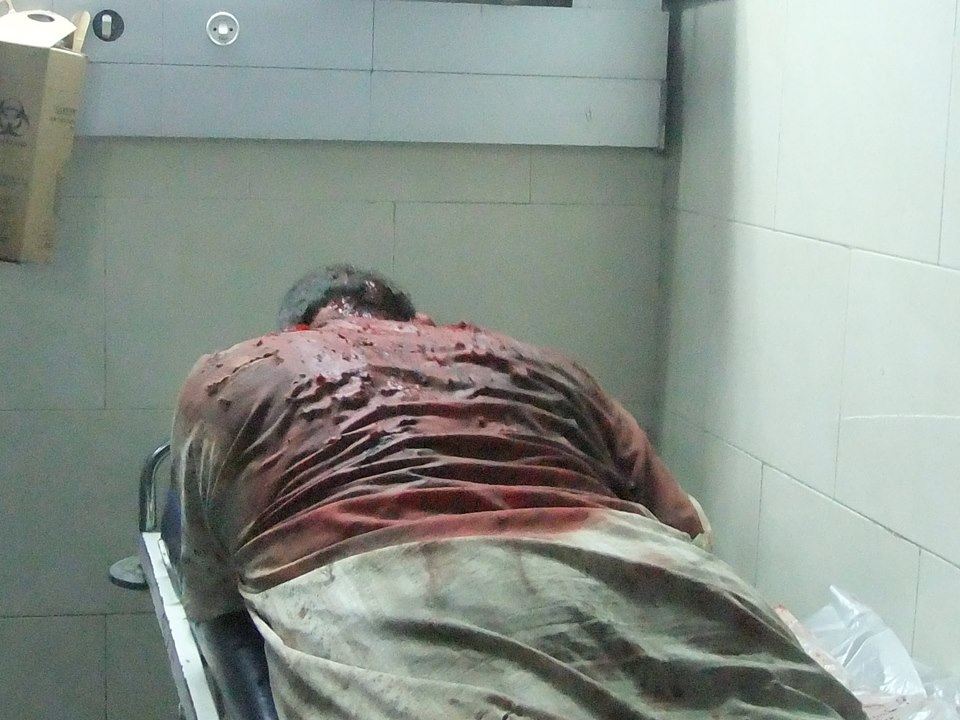 ارتفاع حصيلة شهداء مجزرة الشجاعية إلى 75 شهيداً قصف على غزة