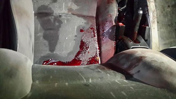 الاحتلال يصيب مواطناً بجروحٍٍ خطرة في بيت أمر صور