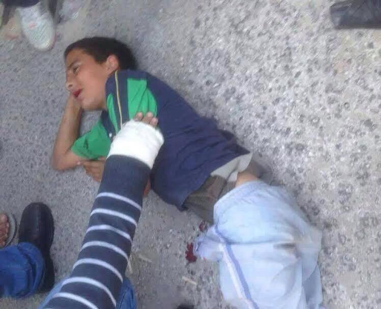 مستوطن يدهس طفلاً جنوب الخليل دهس طفل
