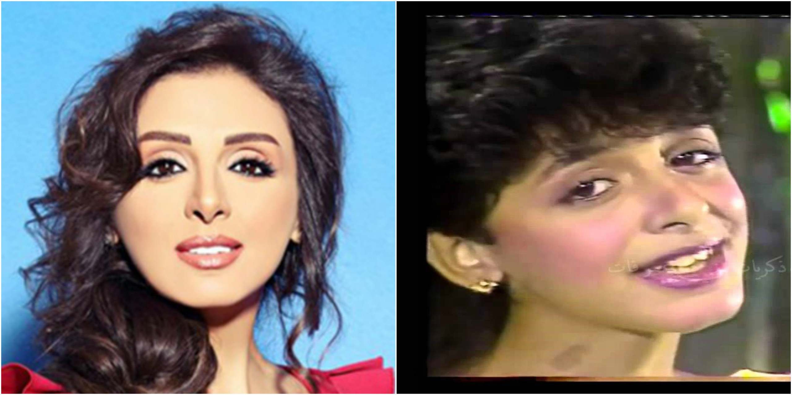 صور: كيف غيّر المال هؤلاء الفنانين؟