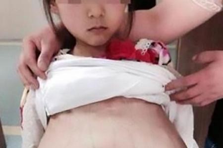 بيعت كعروس قاصر.. والآن حامل من رجل في الـ40!