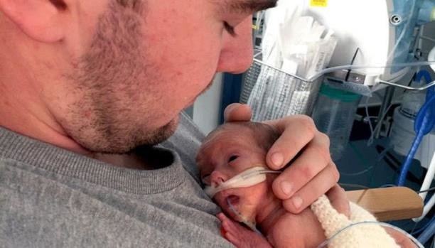 نجت من الموت لكنها ولدت بحجم كف اليد