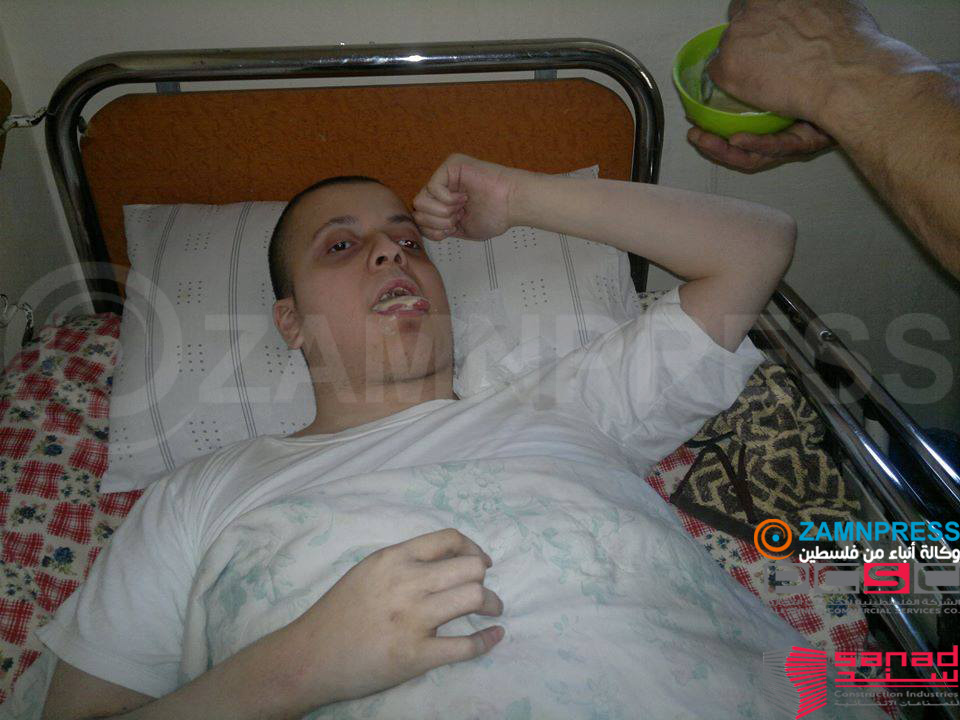 مؤمن الصانع...الحياة بين معاناة الشلل الدماغي و"السيريلاك" الشلل الدماغي
