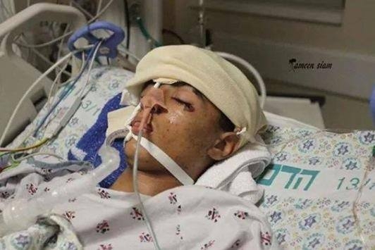 اسرائيل قتلت الطفل سنقرط برصاصة اسفنجية تستخدم لاول مرة اسرائيل