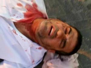 مستوطنون يعتدون على مواطن في اللد