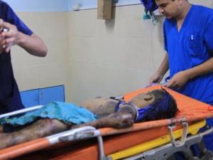 استشهاد أطفال 