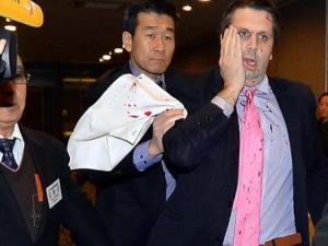 بيونغ يانغ: لا علاقة لنا بالهجوم على السفير الأمريكي