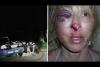 Embedded thumbnail for بالفيديو ..حالة من الغضب بعد تحطيم الشرطة الأميركية وجه امرأة خلال توقيفها